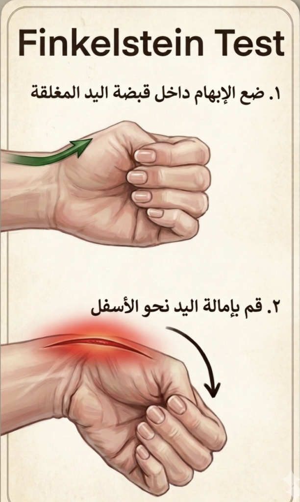 التهاب وتر الإبهام: الأسباب والأعراض وخطوات العلاج الطبيعي الفعّال 4 IMG 20260602 121635 033632 التهاب وتر الإبهام: الأسباب والأعراض وخطوات العلاج الطبيعي الفعّال